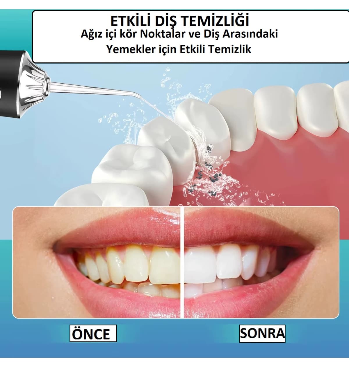دستگاه شستشوی دهان و دندان قابل شارژ TeknoClass ۴ سر قابل حمل سیاه دستگاه شستشوی دهان و دندان قابل شارژ TeknoClass ۴ سر قابل حمل سیاه
