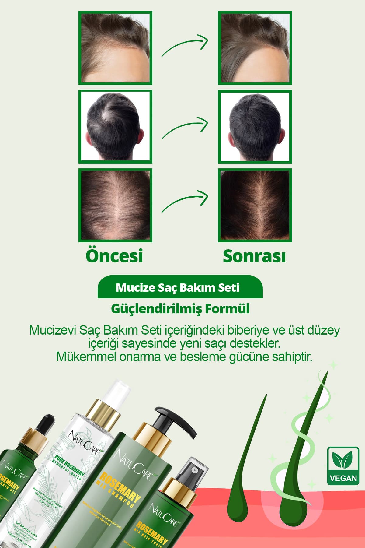 ست مراقبت از مو NatuCare مدل Biberiye Mucizesi 4 عددی ضدریزش ست مراقبت از مو NatuCare مدل Biberiye Mucizesi 4 عددی ضدریزش