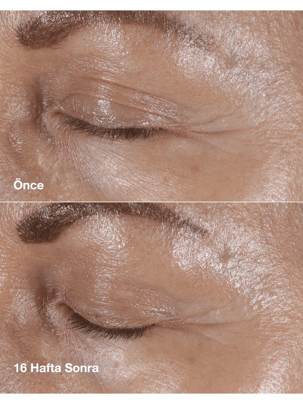 کرم دور چشم Clinique ضد خطوط و چروک Smart Clinical Repair 15ml کرم دور چشم Clinique ضد خطوط و چروک Smart Clinical Repair 15ml