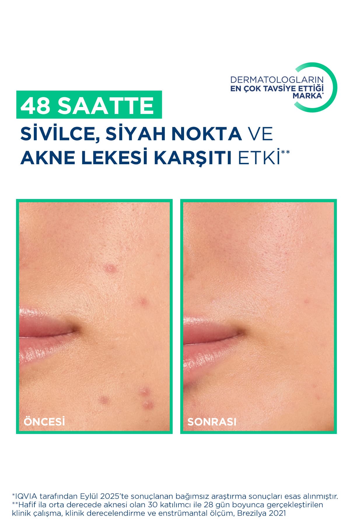 کرم مرطوبکننده ضد جوش و لک و جوشهای سرسیاه Bioderma حاوی اسید سالیسیلیک مدل Sebium Kerato+ 30ml کرم مرطوبکننده ضد جوش و لک و جوشهای سرسیاه Bioderma حاوی اسید سالیسیلیک مدل Sebium Kerato+ 30ml