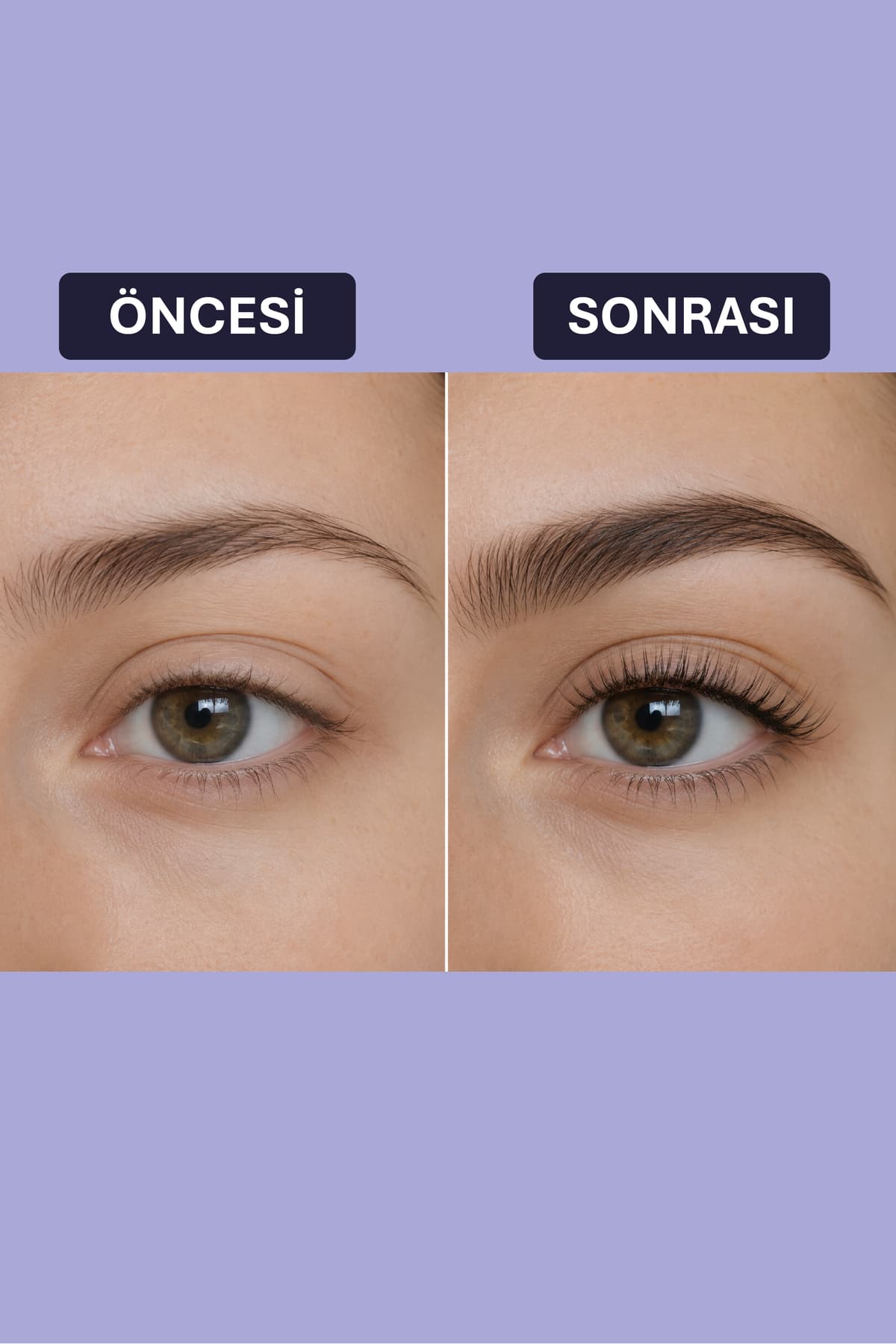 سرم تقویتکننده و بلندکننده ابرو و مژه Ashley Joy حاوی کراتین و بیوتین 6 ml سرم تقویتکننده و بلندکننده ابرو و مژه Ashley Joy حاوی کراتین و بیوتین 6 ml