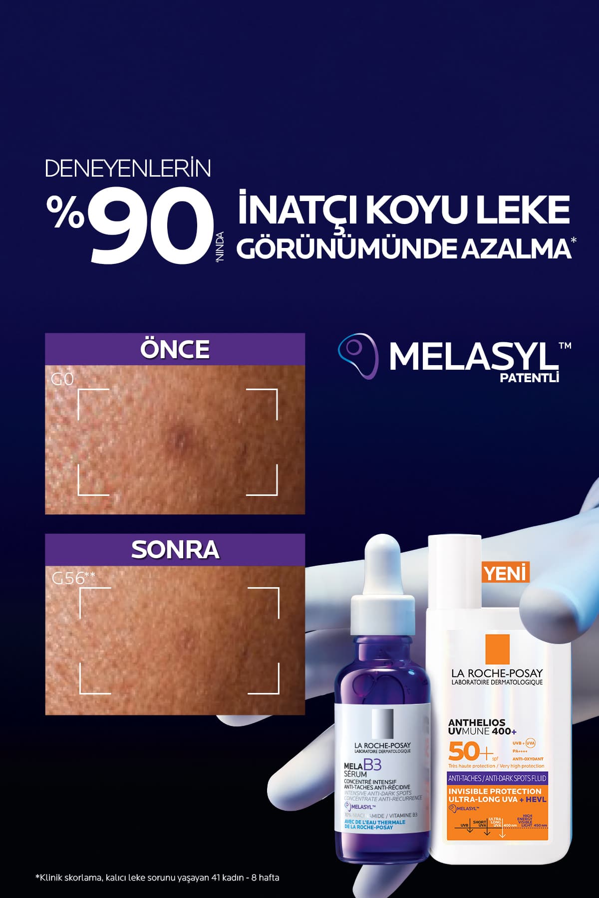 ضدآفتاب صورت پوستهای لکدار La Roche Posay Anthelios Uvmune فلوئید ضدلک با محافظت بالا SPF50+ 50ml ضدآفتاب صورت پوستهای لکدار La Roche Posay Anthelios Uvmune فلوئید ضدلک با محافظت بالا SPF50+ 50ml