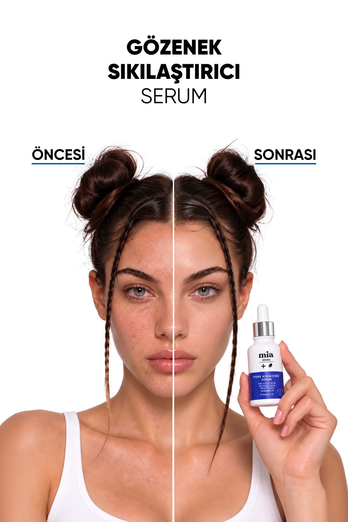 سرم mia klinika برای کاهش منافذ و سرسیاه با Niacinamide 30 ml سرم mia klinika برای کاهش منافذ و سرسیاه با Niacinamide 30 ml