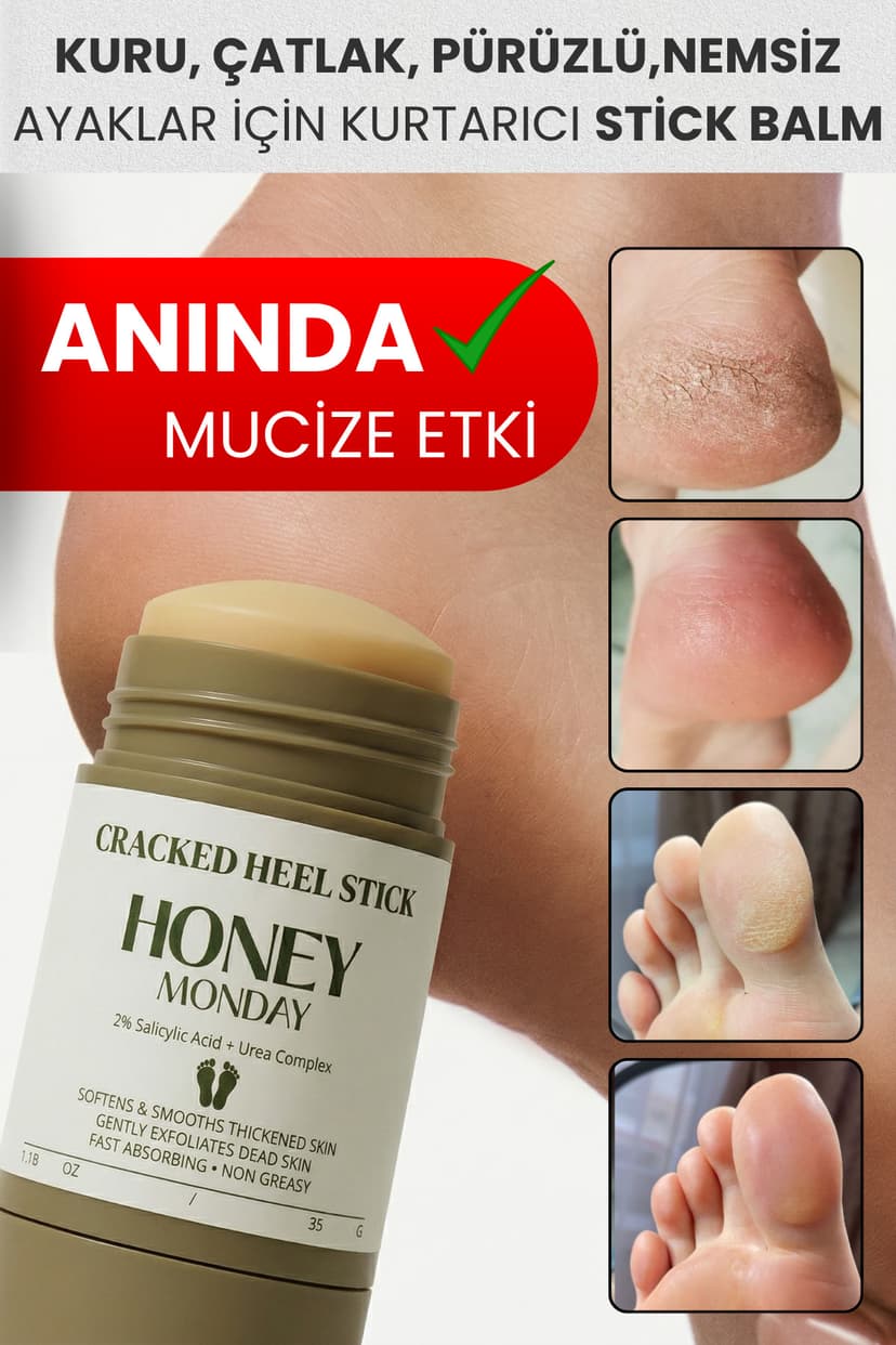 مراقبت ترک پا و پاشنه Honey Monday برای بوی پا و پاشنههای زبر 35 گرم مراقبت ترک پا و پاشنه Honey Monday برای بوی پا و پاشنههای زبر 35 گرم
