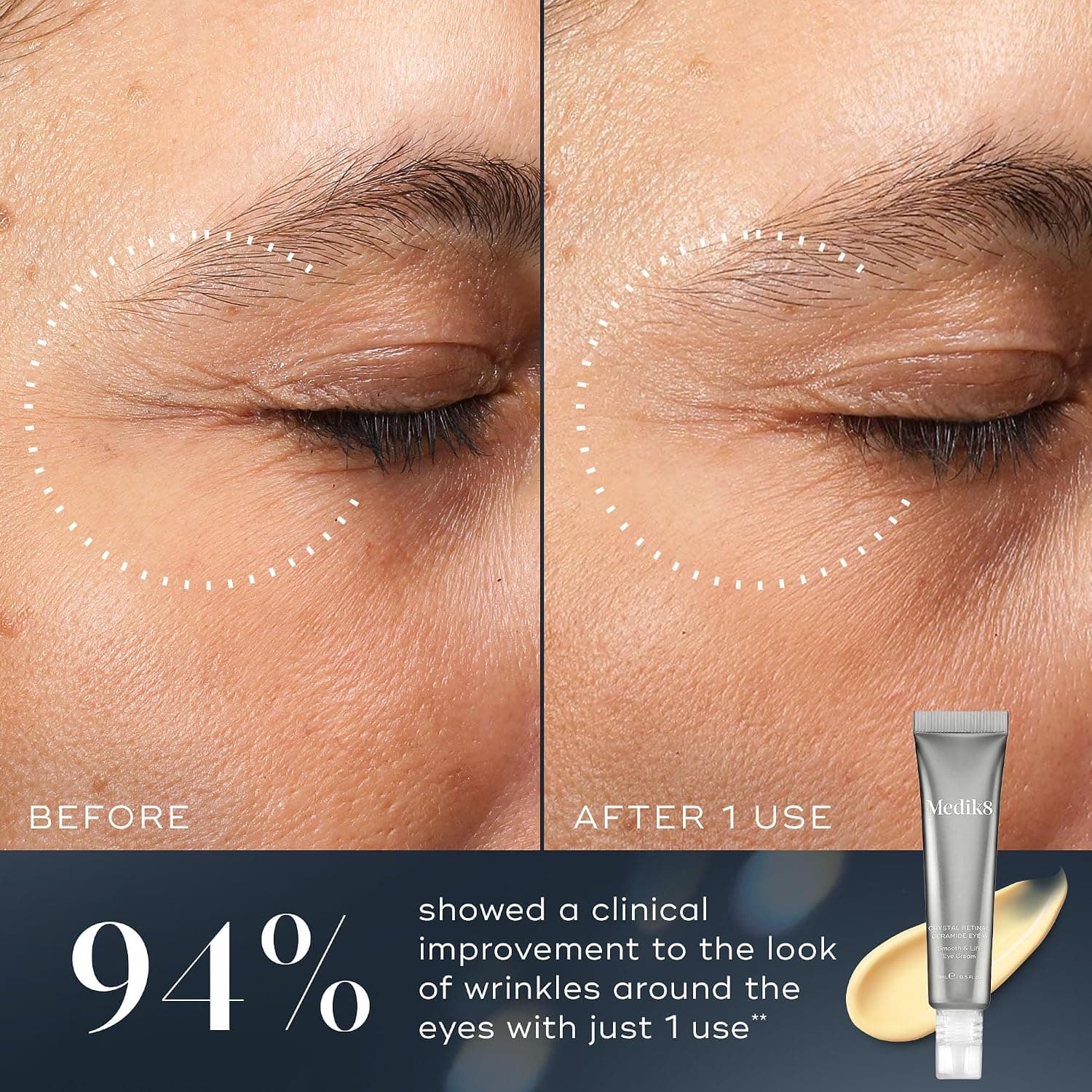 مراقبت دور چشم Medik8 Crystal Retinal Ceramide Eye 6 مراقبت دور چشم Medik8 Crystal Retinal Ceramide Eye 6