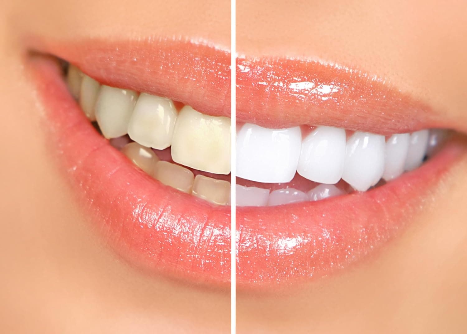 ژل سفیدکننده دندان Dr. George's Dental White همراه با دستورالعمل ژل سفیدکننده دندان Dr. George's Dental White همراه با دستورالعمل
