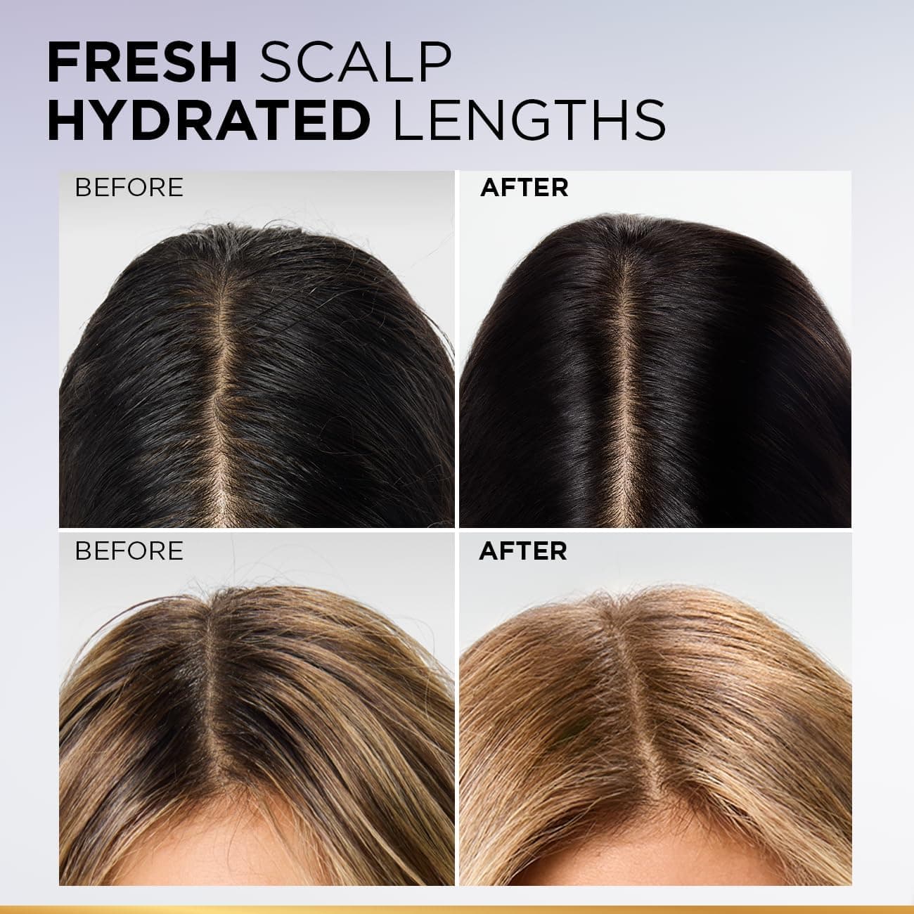 شامپو پوست سر چرب L'Oreal Paris Elvive Hyaluron Pure 200ml شامپو پوست سر چرب L'Oreal Paris Elvive Hyaluron Pure 200ml