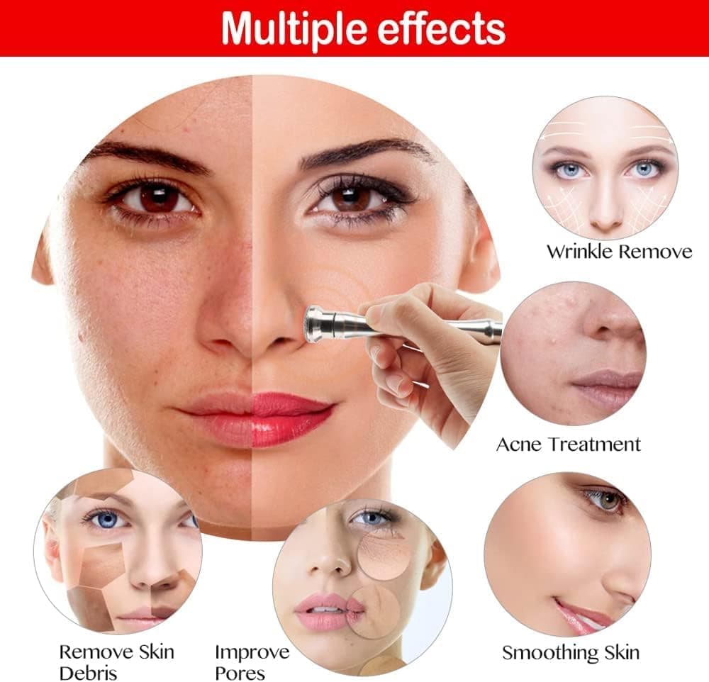 دستگاه میکرودرمابریژن الماسی Titoe برای سالن مراقبت از صورت دستگاه میکرودرمابریژن الماسی Titoe برای سالن مراقبت از صورت