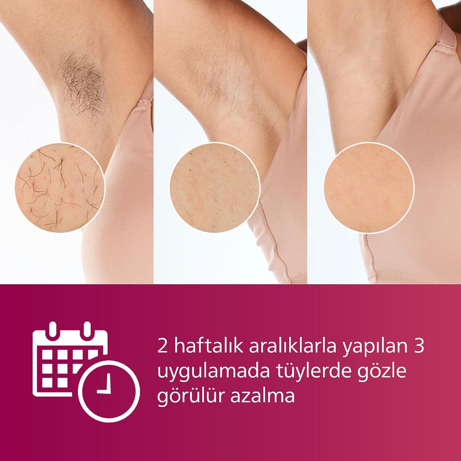 دستگاه لیزر اپیلیشن IPL Philips هد بدن و صورت سفید مدل BRI921/00 دستگاه لیزر اپیلیشن IPL Philips هد بدن و صورت سفید مدل BRI921/00