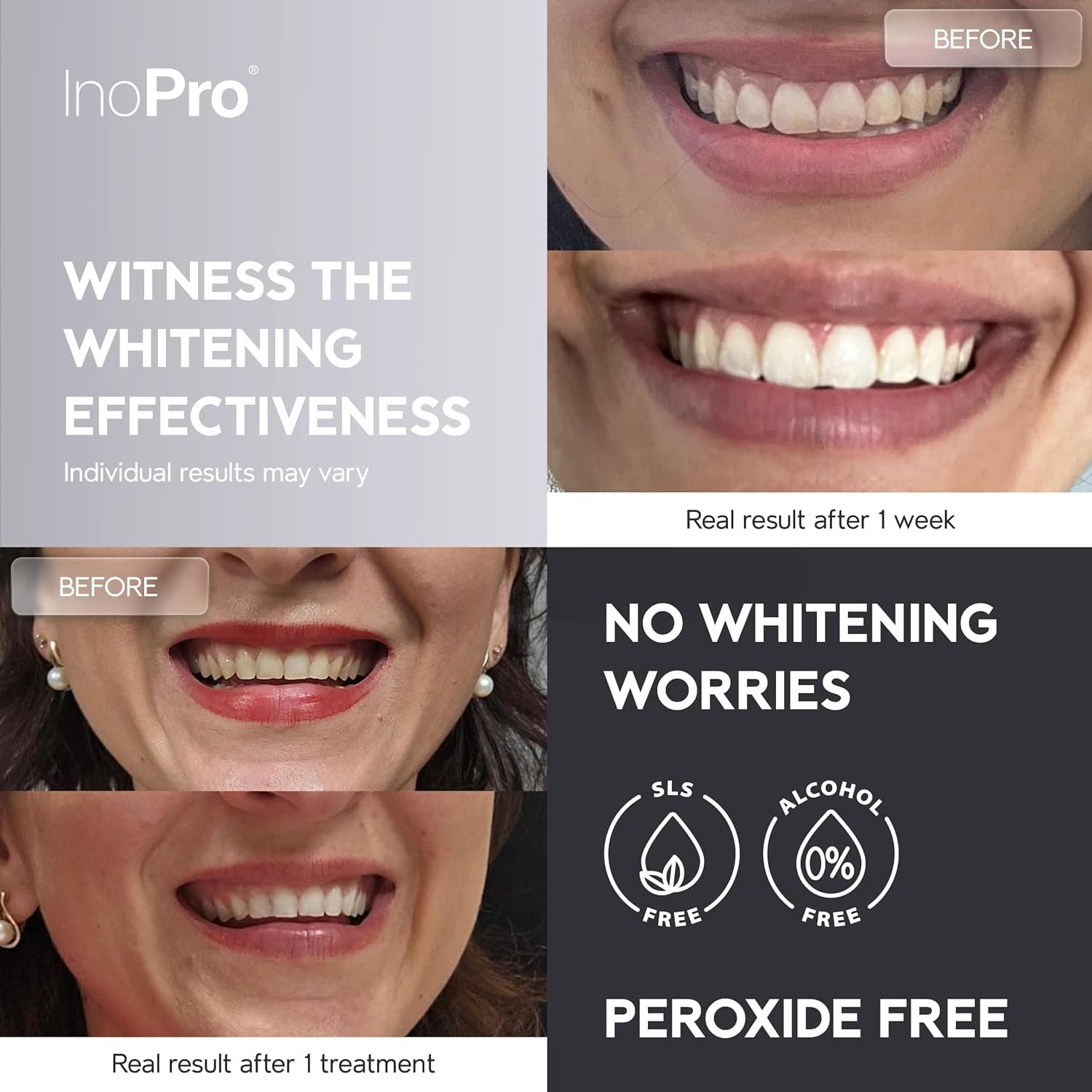 نوار سفیدکننده دندان InoPro بدون پراکسید برای دندان حساس 28 Strips نوار سفیدکننده دندان InoPro بدون پراکسید برای دندان حساس 28 Strips