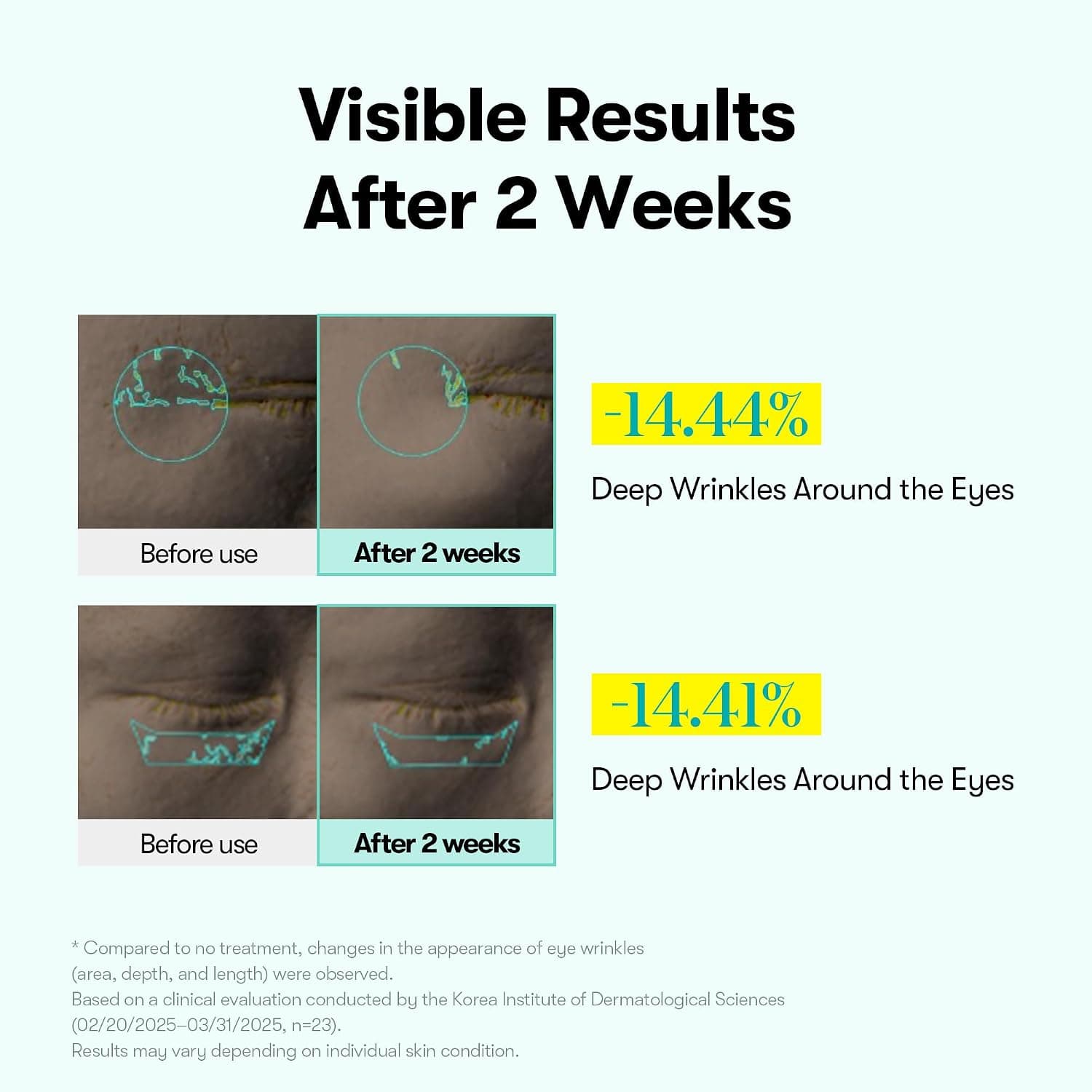 کرم دور چشم VT PDRN REEDLE SHOT EYE LIFTER 15ml با اثر بالابرندگی کرم دور چشم VT PDRN REEDLE SHOT EYE LIFTER 15ml با اثر بالابرندگی