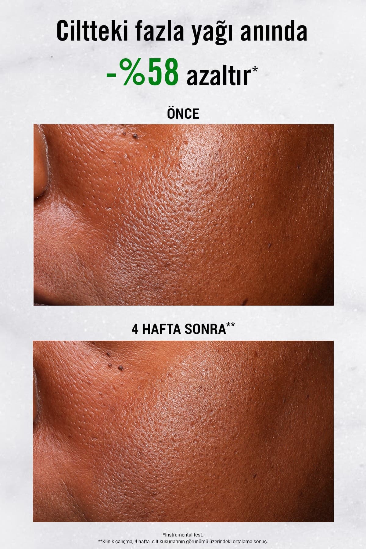 سرم صورت Kiehl's Ultra Pure 5% Niacinamide کاهشدهنده چربی سرم صورت Kiehl's Ultra Pure 5% Niacinamide کاهشدهنده چربی