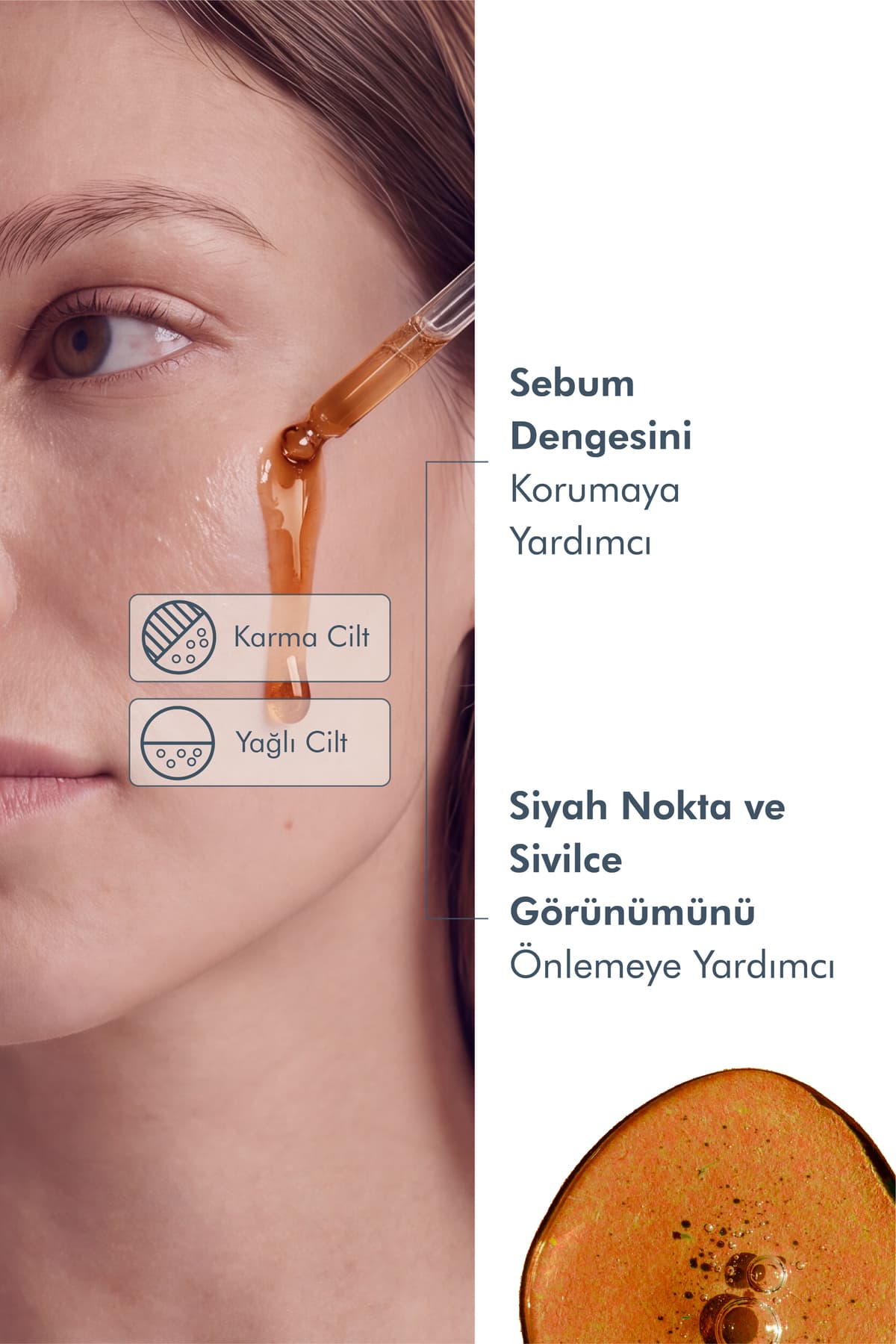 سرم ضد منافذ و جوش سرسیاه The Purest Solutions با Niacinamide 5% و Zinc Pca 1% حجم 30 ML سرم ضد منافذ و جوش سرسیاه The Purest Solutions با Niacinamide 5% و Zinc Pca 1% حجم 30 ML