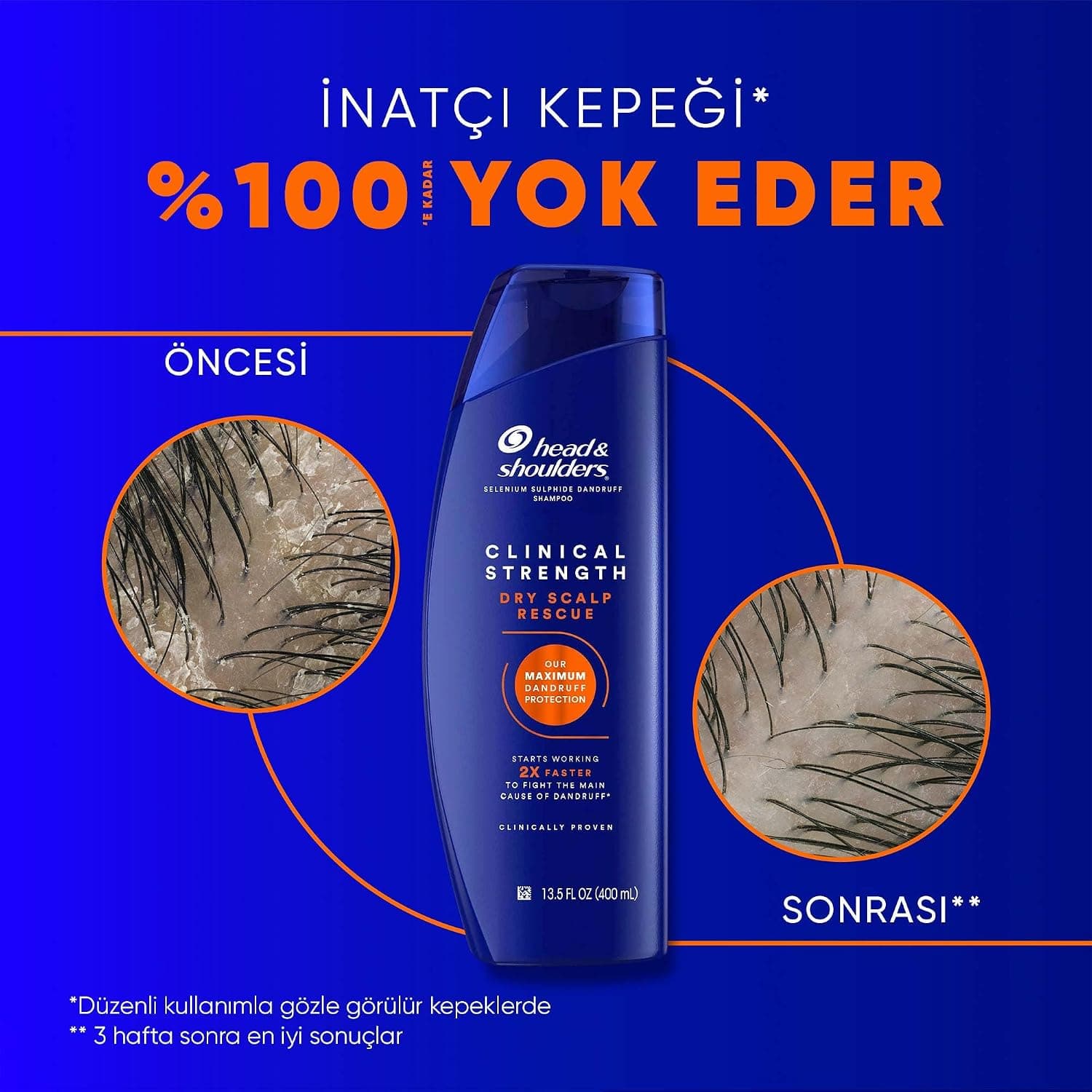 شامپو Head & Shoulders Dry Scalp Rescue مخصوص پوست سر خشک 400 ml شامپو Head & Shoulders Dry Scalp Rescue مخصوص پوست سر خشک 400 ml