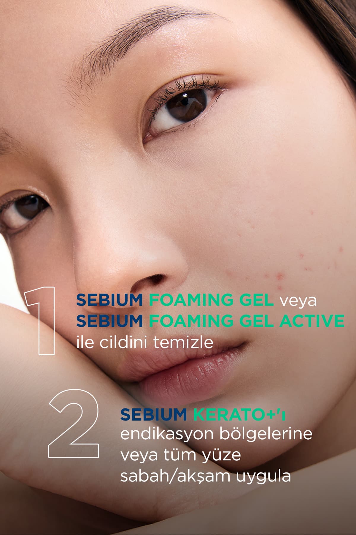 کرم مرطوبکننده ضد جوش و لک و جوشهای سرسیاه Bioderma حاوی اسید سالیسیلیک مدل Sebium Kerato+ 30ml کرم مرطوبکننده ضد جوش و لک و جوشهای سرسیاه Bioderma حاوی اسید سالیسیلیک مدل Sebium Kerato+ 30ml