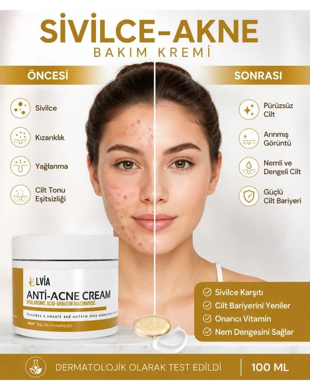 کرم صورت ضدجوش و ضدلک LVİA حاوی ویتامین، ضد جوش سرسیاه کرم صورت ضدجوش و ضدلک LVİA حاوی ویتامین، ضد جوش سرسیاه