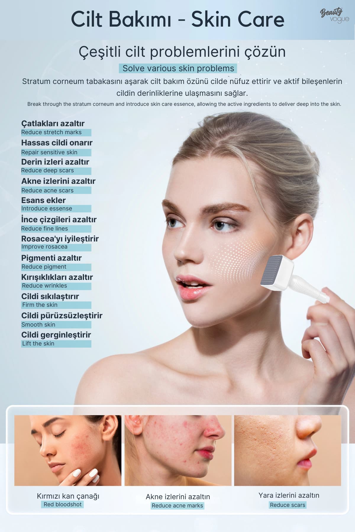 دستگاه میکرونیدلینگ Beauty Vogue مدل BioNeedle 140 سوزنی قابل تنظیم دستگاه میکرونیدلینگ Beauty Vogue مدل BioNeedle 140 سوزنی قابل تنظیم