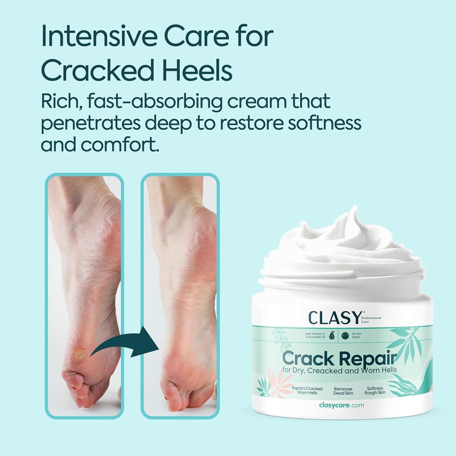 کرم ترک پاشنه CLASYCARE با ویتامین E و روغن آووکادو 100 ml کرم ترک پاشنه CLASYCARE با ویتامین E و روغن آووکادو 100 ml