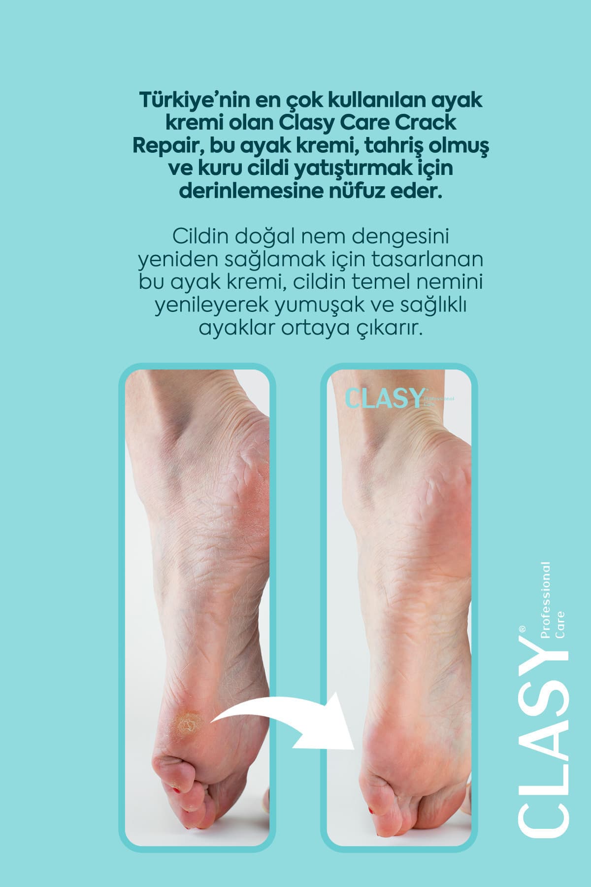 کرم ترک پا و پاشنه Clasy Care ضد بوی پا 100ml کرم ترک پا و پاشنه Clasy Care ضد بوی پا 100ml