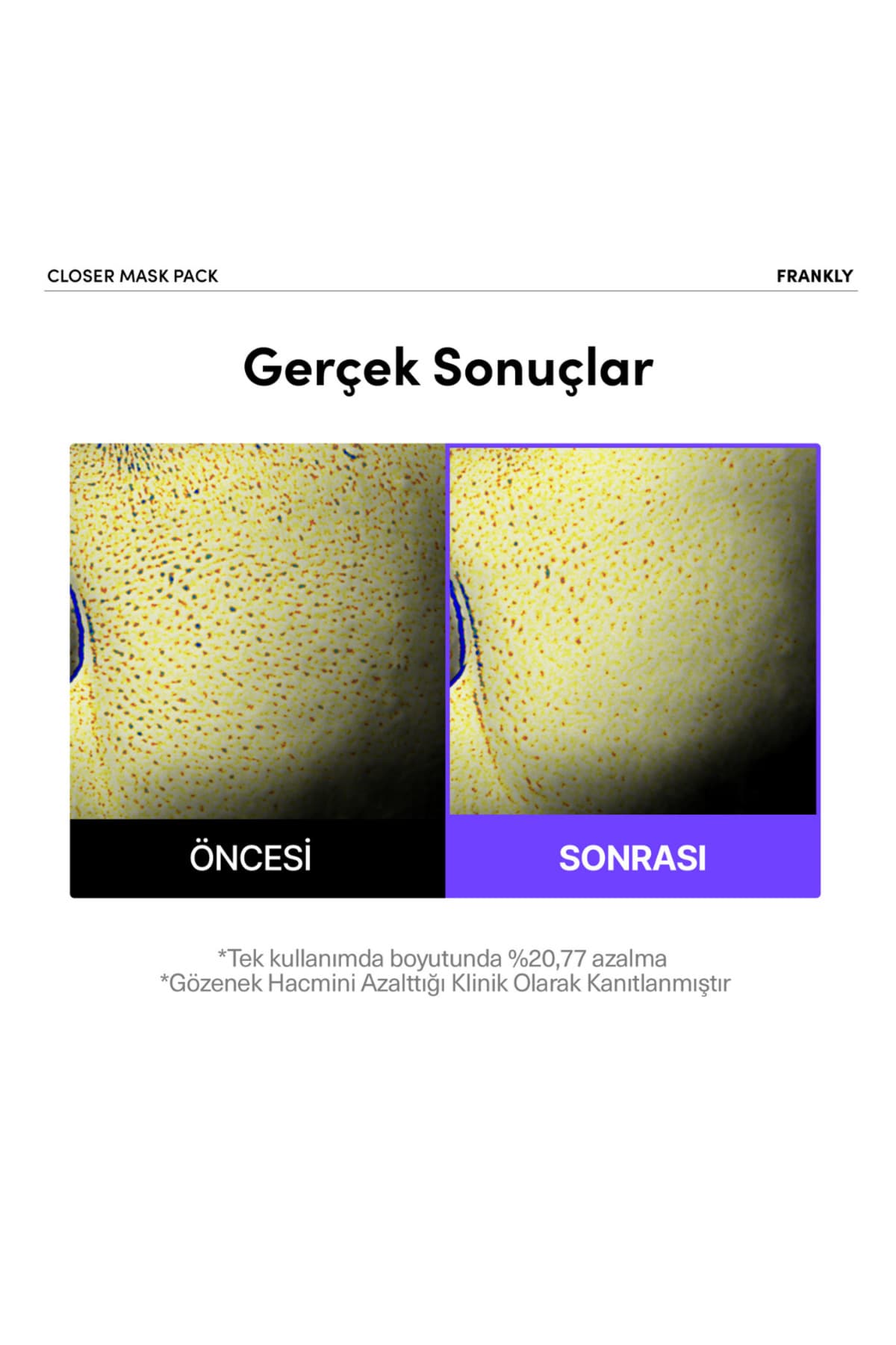 ماسک ورقهای FRANKLY سفتکننده منافذ حاوی عصاره برنج، پپتید و کلاژن Closer ماسک ورقهای FRANKLY سفتکننده منافذ حاوی عصاره برنج، پپتید و کلاژن Closer