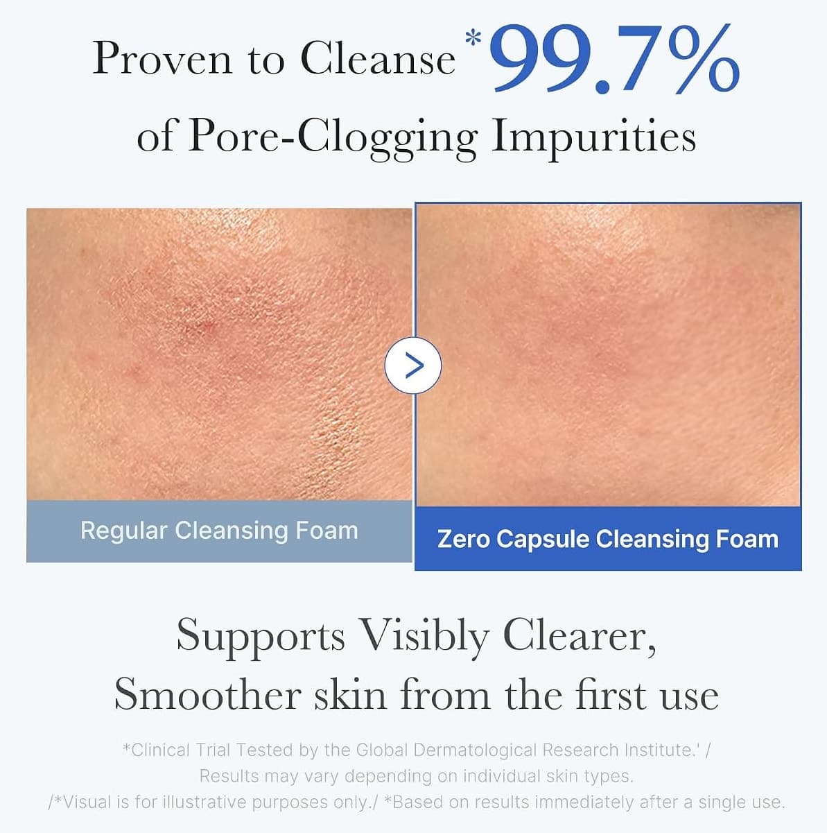 شوینده صورت medicube مراقبت منافذ مدل Zero Pore Clear Blue Capsule 120g شوینده صورت medicube مراقبت منافذ مدل Zero Pore Clear Blue Capsule 120g