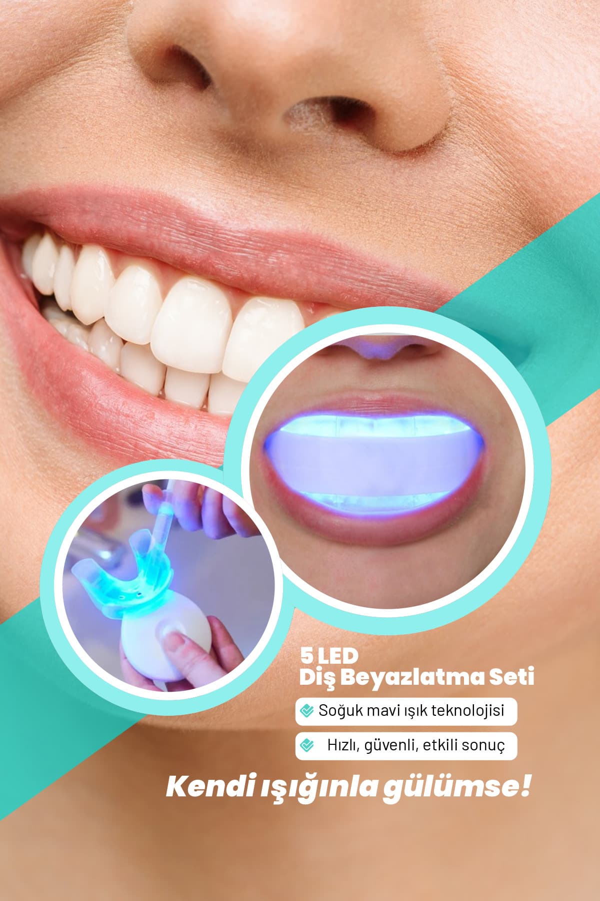 ست سفیدکننده دندان smileshop با 5 LED ست سفیدکننده دندان smileshop با 5 LED