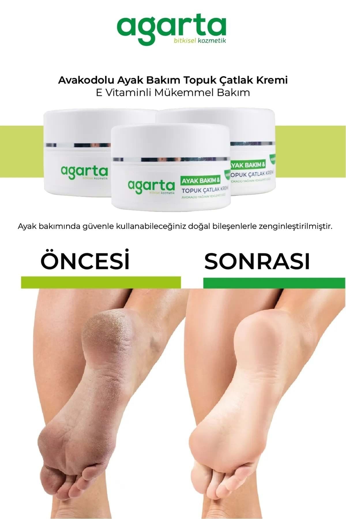 کرم مراقبت از ترک پا و پاشنه Agarta 100ML کرم مراقبت از ترک پا و پاشنه Agarta 100ML