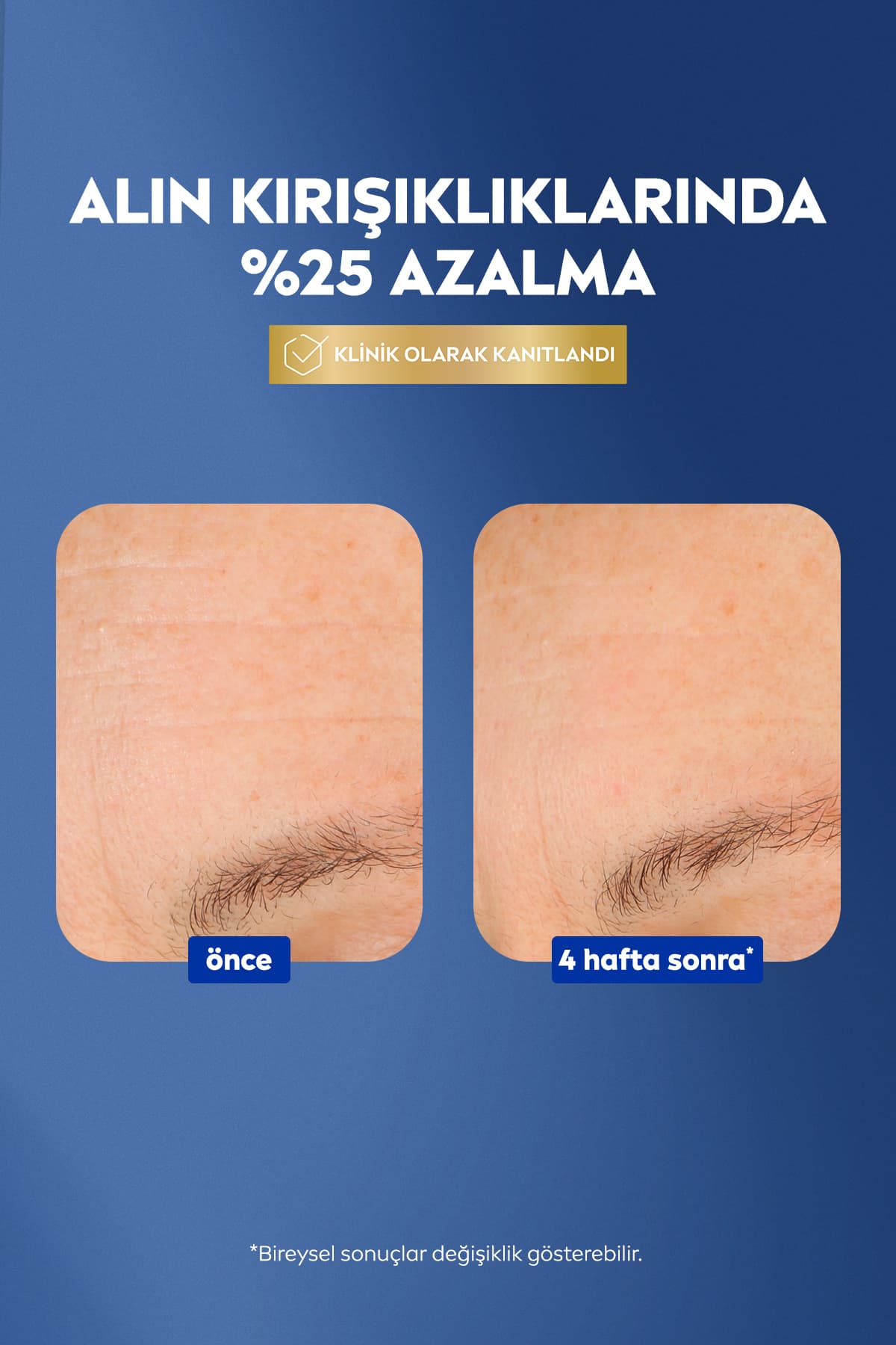 سرم ضدچروک دو اثره پوست NIVEA Q10 برای چروکهای پیشانی 30ml سرم ضدچروک دو اثره پوست NIVEA Q10 برای چروکهای پیشانی 30ml