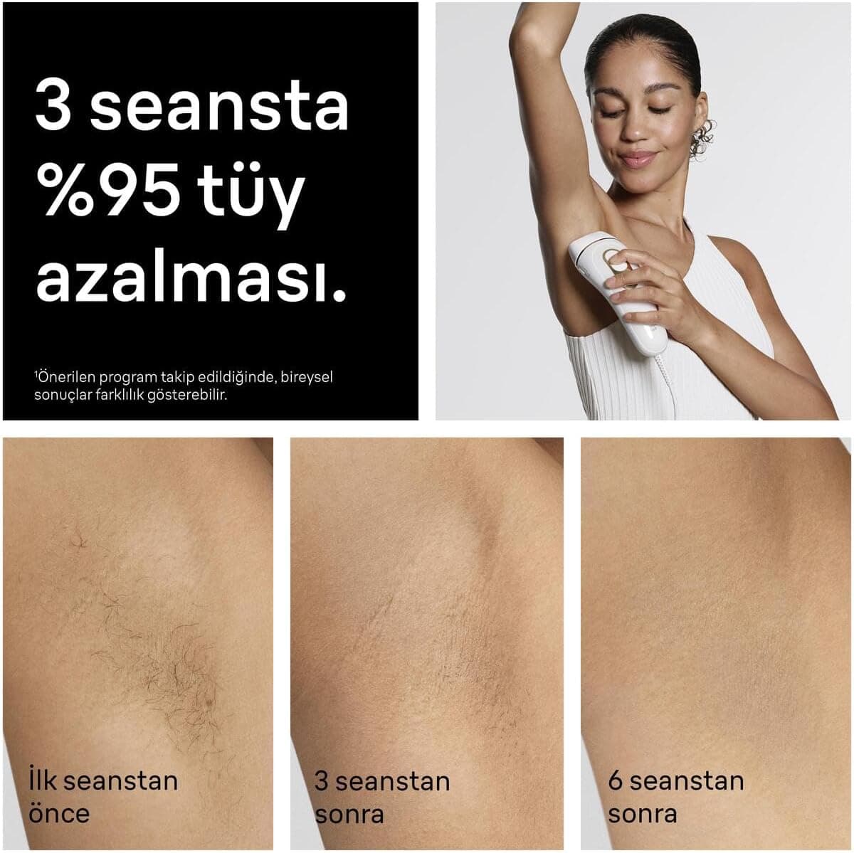 دستگاه موبر خانگی IPL و صورت Braun Silk·expert Pro 5 با 4 سری مدل PL5412 دستگاه موبر خانگی IPL و صورت Braun Silk·expert Pro 5 با 4 سری مدل PL5412