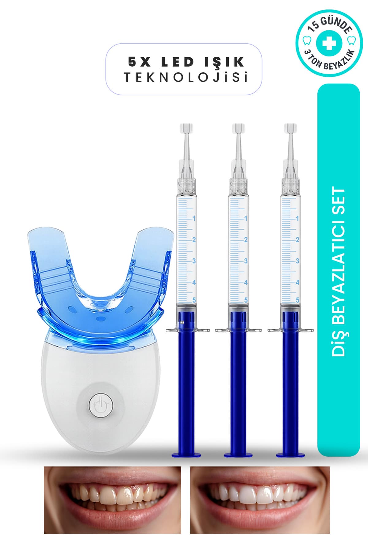 ست سفیدکننده دندان smileshop با 5 LED ست سفیدکننده دندان smileshop با 5 LED