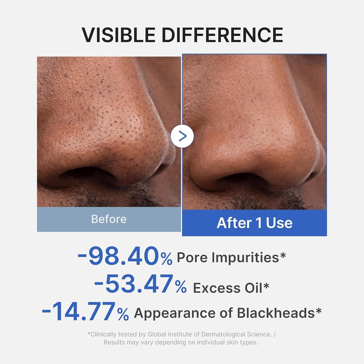 ماسک گلرس برای جوشهای سرسیاه medicube ZERO PORE BLACKHEAD ماسک گلرس برای جوشهای سرسیاه medicube ZERO PORE BLACKHEAD