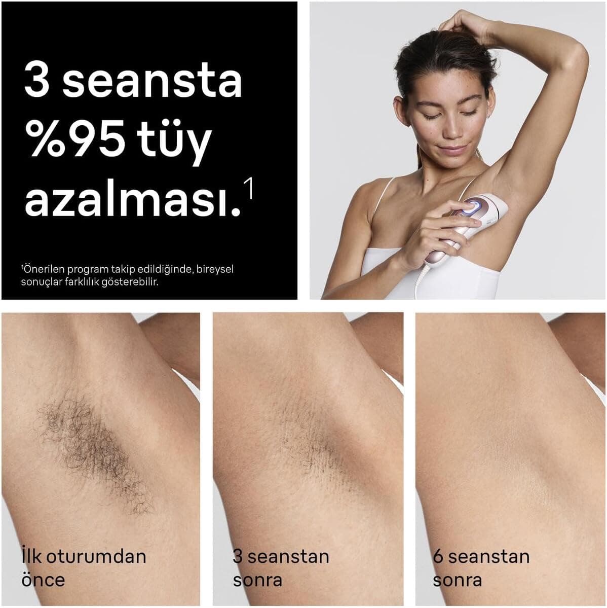 دستگاه هوشمند IPL موزدایی Braun Skin i·expert 7 مدل PL7431 سفید/برنزی دستگاه هوشمند IPL موزدایی Braun Skin i·expert 7 مدل PL7431 سفید/برنزی