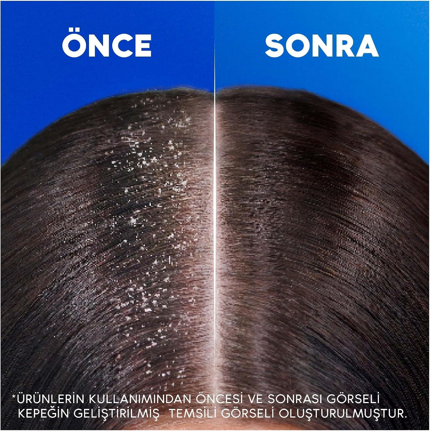 شامپو Head & Shoulders ضد شوره آبرسان عمیق با روغن نارگیل مصرف روزانه 330ML شامپو Head & Shoulders ضد شوره آبرسان عمیق با روغن نارگیل مصرف روزانه 330ML