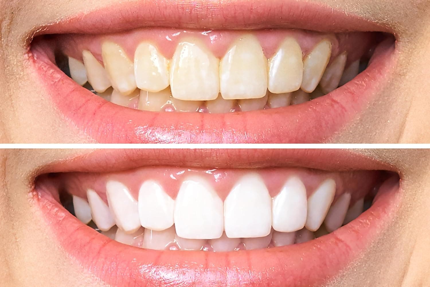 ژل سفیدکننده دندان Dr. George's Dental White همراه با دستورالعمل ژل سفیدکننده دندان Dr. George's Dental White همراه با دستورالعمل