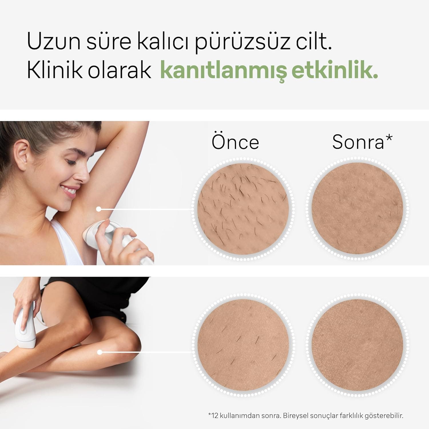 دستگاه IPL رفع موهای زائد Braun Silk·expert Pro 3 مدل PL3132 همراه کیف، خودتراش Venus و 2 سری دستگاه IPL رفع موهای زائد Braun Silk·expert Pro 3 مدل PL3132 همراه کیف، خودتراش Venus و 2 سری