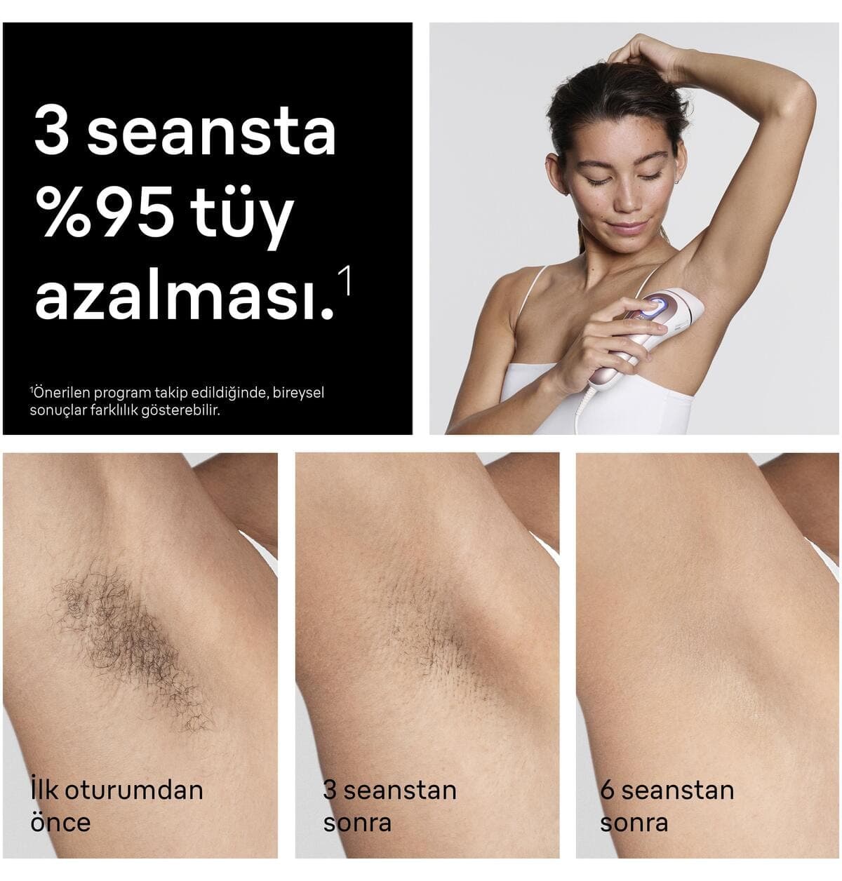 دستگاه لیزر خانگی Braun IPL Skin i·expert مدل PL7431 با اپلیکیشن و ۴ هد دستگاه لیزر خانگی Braun IPL Skin i·expert مدل PL7431 با اپلیکیشن و ۴ هد
