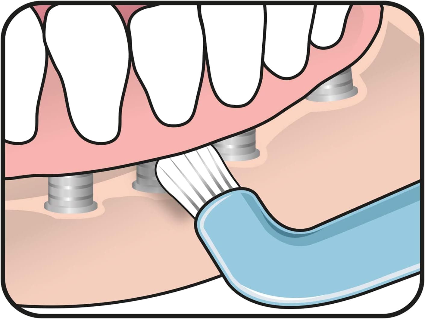 مسواک تکدسته TePe Compact Tuft با برس گرد مناسب ایمپلنت و پروتز، رنگهای متنوع مسواک تکدسته TePe Compact Tuft با برس گرد مناسب ایمپلنت و پروتز، رنگهای متنوع
