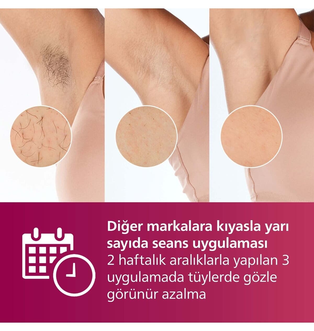 دستگاه موزن IPL Philips Lumea 7000 مدل BRI924/00 صورت و بدن ۲ هد کیف دستگاه موزن IPL Philips Lumea 7000 مدل BRI924/00 صورت و بدن ۲ هد کیف