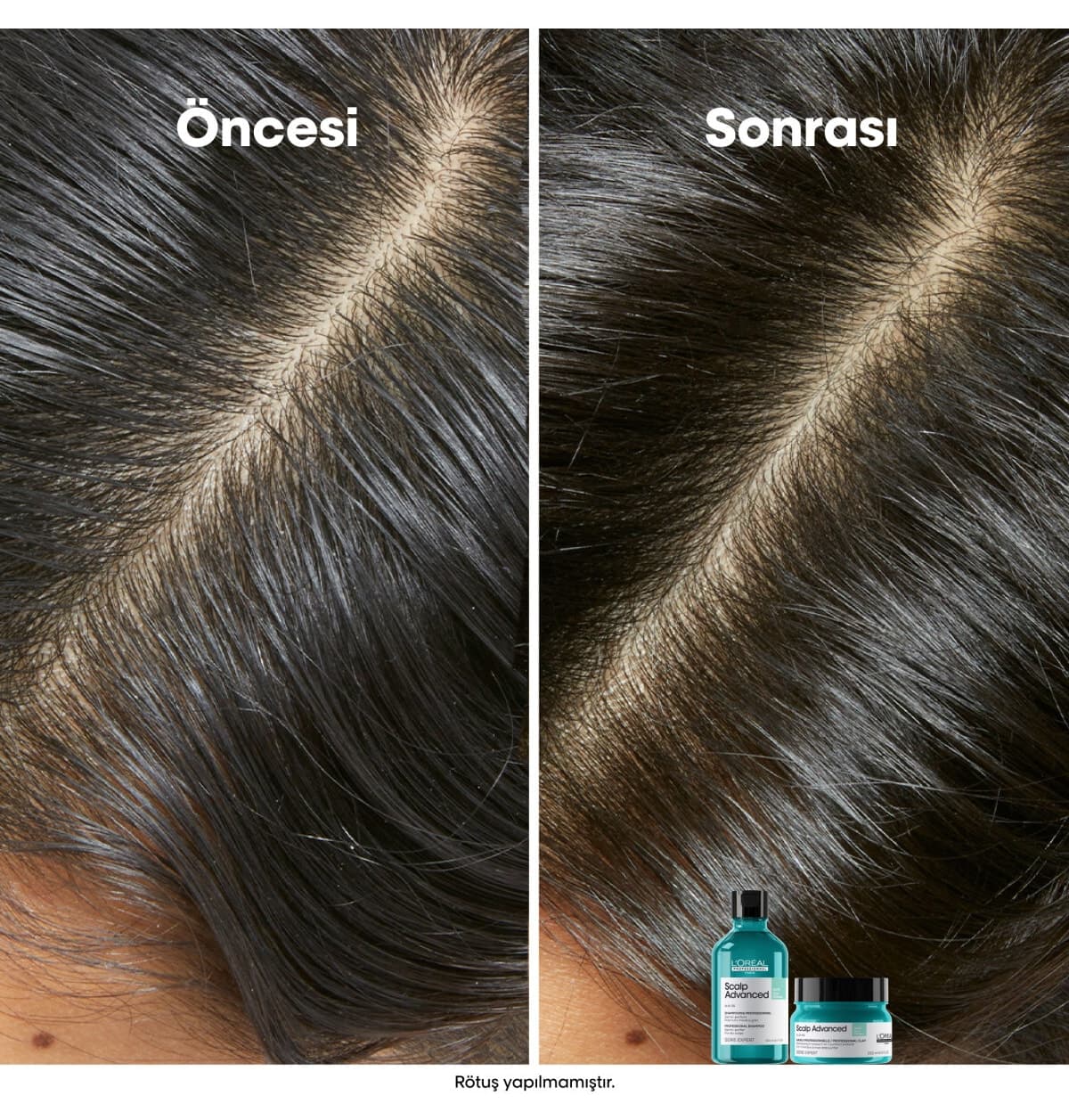 شامپو زنانه L'oreal Professionnel ضد چرب شدن Serie Expert Scalp Advanced 500ml شامپو زنانه L'oreal Professionnel ضد چرب شدن Serie Expert Scalp Advanced 500ml