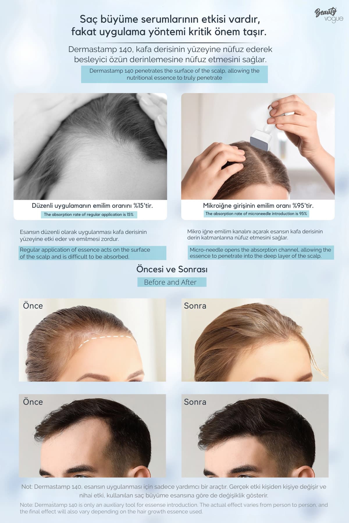 دستگاه میکرونیدلینگ Beauty Vogue مدل BioNeedle 140 سوزنی قابل تنظیم دستگاه میکرونیدلینگ Beauty Vogue مدل BioNeedle 140 سوزنی قابل تنظیم
