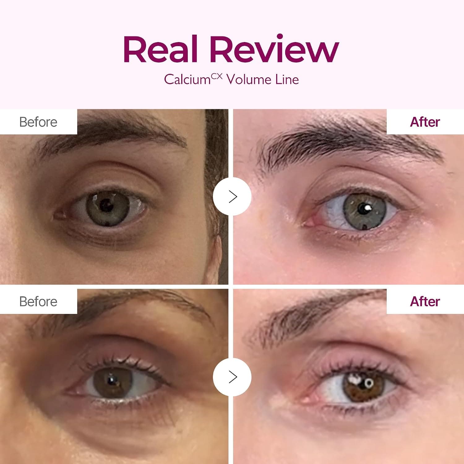 کرم دور چشم DR.MELAXIN مدل CEMENRETE کرم دور چشم DR.MELAXIN مدل CEMENRETE