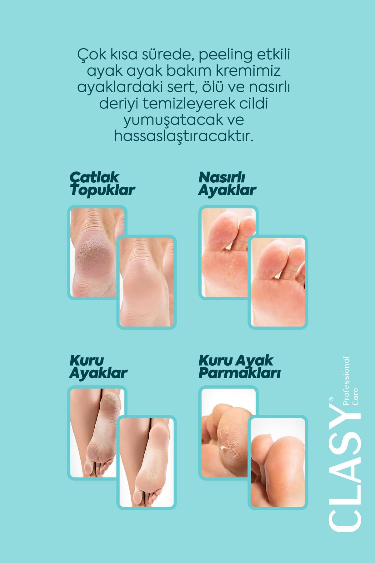 کرم ترک پا و پاشنه Clasy Care ضد بوی پا 100ml کرم ترک پا و پاشنه Clasy Care ضد بوی پا 100ml
