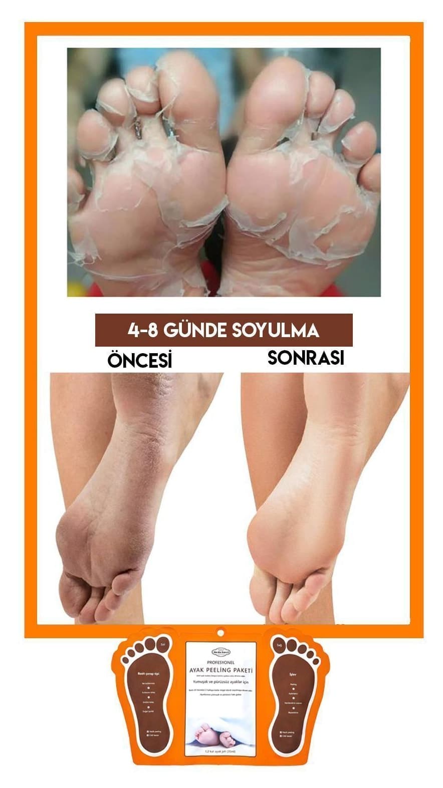 ماسک لایهبردار پای جورابی LUPİX بسته 2 عددی ماسک لایهبردار پای جورابی LUPİX بسته 2 عددی