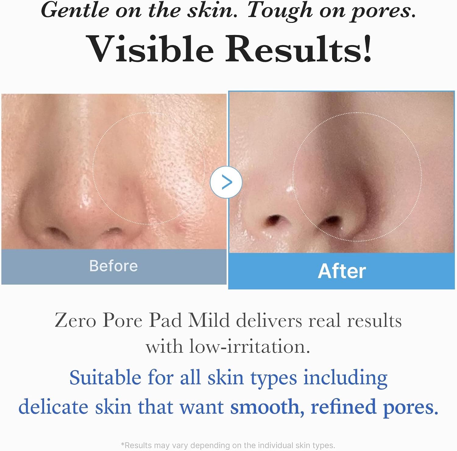 پد تونر لایهبردار medicube Zero Pore Pads Mild 2.0 با PHA برای کاهش منافذ و جوش سر سیاه پد تونر لایهبردار medicube Zero Pore Pads Mild 2.0 با PHA برای کاهش منافذ و جوش سر سیاه